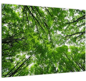 Slika - Pogled u krošnje drveća (70x50 cm)