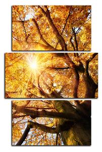 Slika na platnu - Sunce kroz grane drveća - pravokutnik 7240C (90x60 cm)