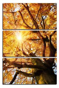 Slika na platnu - Sunce kroz grane drveća - pravokutnik 7240B (90x60 cm )