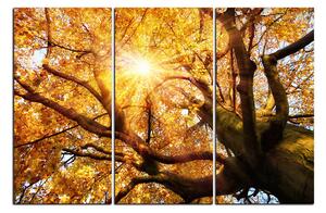 Slika na platnu - Sunce kroz grane drveća 1240B (120x80 cm)