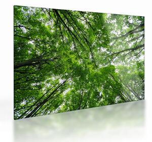 Staklena slika - Pogled u krošnje drveća (70x50 cm)