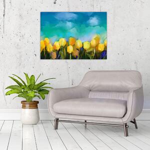 Slika rumenih tulipanov (70x50 cm)